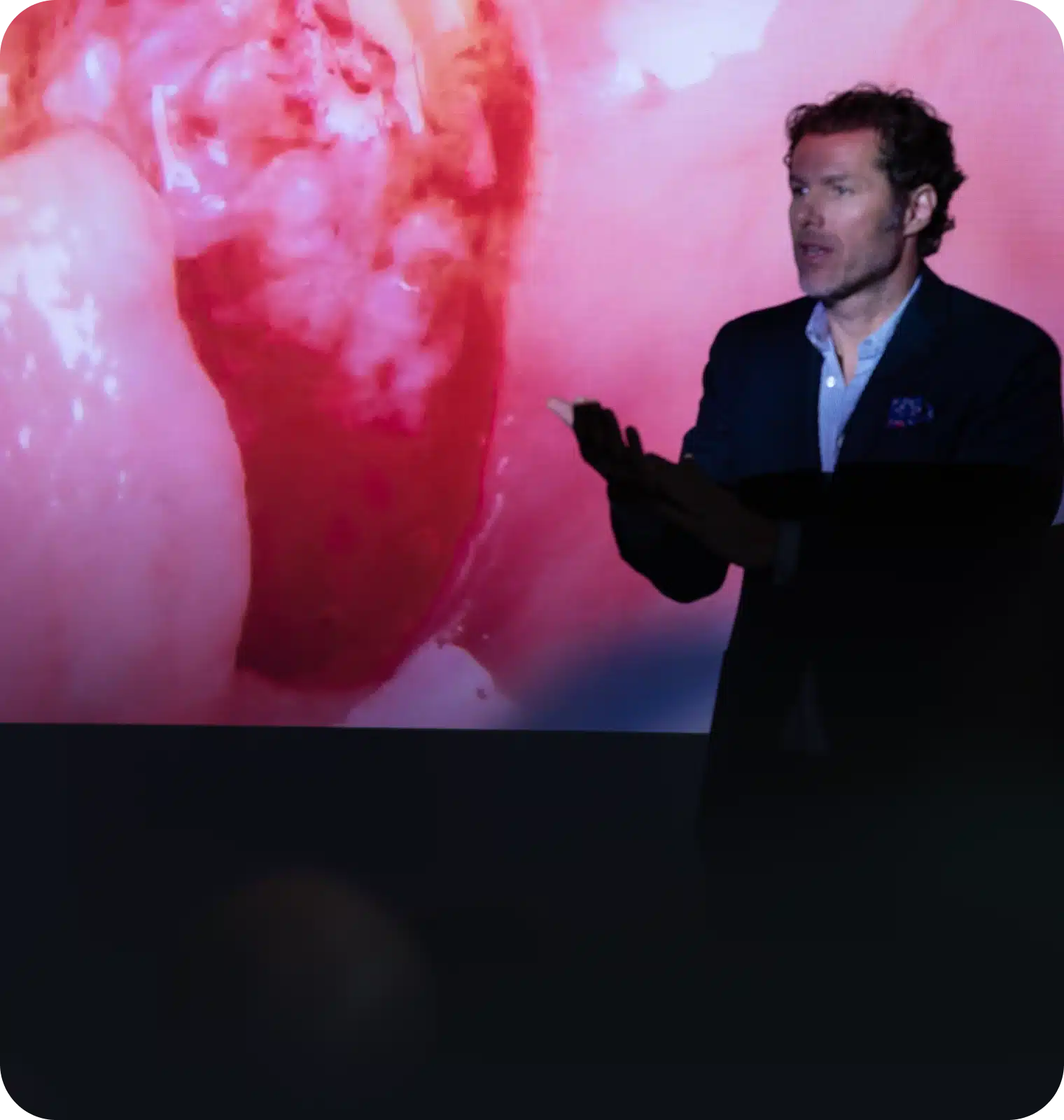 PRISM Masterclass — Predictable Reconstruction of Interproximal Soft Tissue Morphology